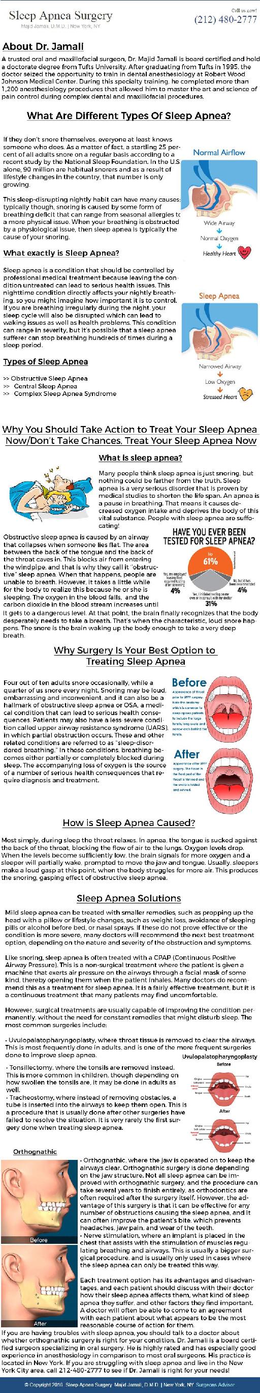 Sleep Apnea Surgery Infographics