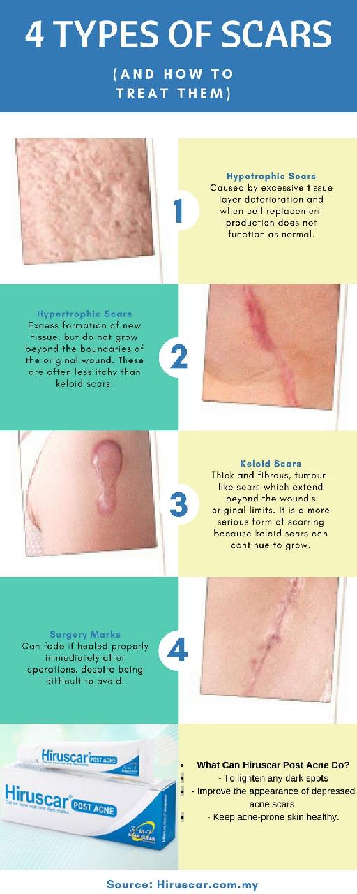 4 Types of Scars and How to Remove Them