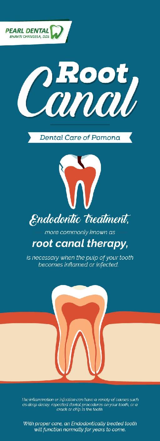 Get The Best Root Canal Treatment at Pearl Dental Care
